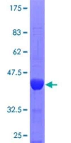 Novus Biologicals Recombinant Human Astrin GST (N-Term) Protein 25 &mu;g | Buy Online | Novus Biologicals&trade; | Fisher Scientific