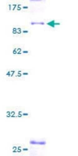 Novus Biologicals Recombinant Human RPC62 GST (N-Term) Protein 2 &mu;g | Buy Online | Novus Biologicals&trade; | Fisher Scientific