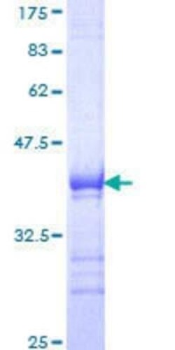 Novus Biologicals Recombinant Human TAF6L GST (N-Term) Protein 25 &mu;g | Buy Online | Novus Biologicals&trade; | Fisher Scientific