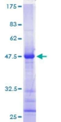 Novus Biologicals Recombinant Human RASL10A GST (N-Term) Protein 25 &mu;g | Buy Online | Novus Biologicals&trade; | Fisher Scientific