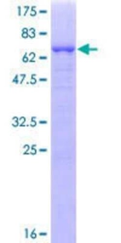 Novus Biologicals Recombinant Human RAD51AP1 GST (N-Term) Protein 10 &mu;g | Buy Online | Novus Biologicals&trade; | Fisher Scientific