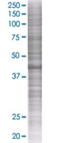 Novus Biologicals&trade;&nbsp;RAD51AP1 293T Cell Transient Overexpression Lysate