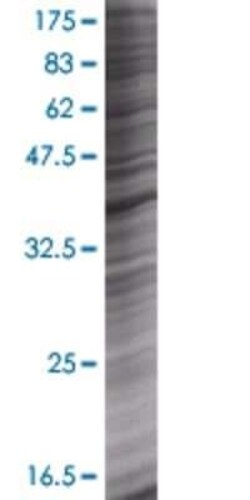 Novus Biologicals RAD51AP1 293T Cell Transient Overexpression Lysate 0.1 mL | Buy Online | Novus Biologicals&trade; | Fisher Scientific