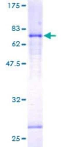 Novus Biologicals Recombinant Human Lefty-1 GST (N-Term) Protein 25 &mu;g | Buy Online | Novus Biologicals&trade; | Fisher Scientific