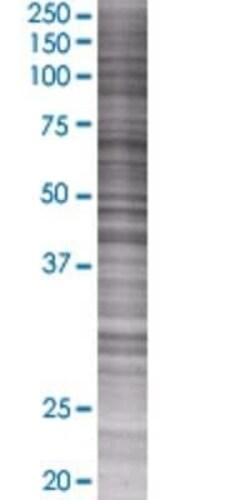 Novus Biologicals Lefty-1 293T Cell Transient Overexpression Lysate 0.1 mL | Buy Online | Novus Biologicals&trade; | Fisher Scientific