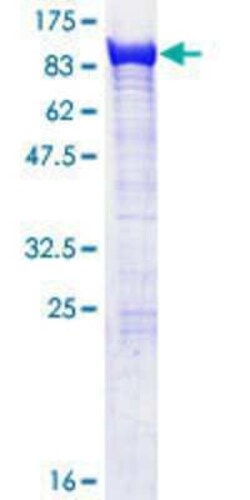 Novus Biologicals Recombinant Human EXOC5 GST (N-Term) Protein 25 &mu;g | Buy Online | Novus Biologicals&trade; | Fisher Scientific