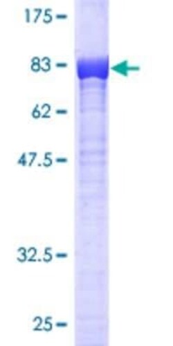 Novus Biologicals Recombinant Human IMP2/IGF2BP2 GST (N-Term) Protein 2 &mu;g | Buy Online | Novus Biologicals&trade; | Fisher Scientific