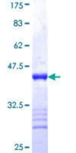 Novus Biologicals Recombinant Human IMP2/IGF2BP2 GST (N-Term) Protein 10 &mu;g | Buy Online | Novus Biologicals&trade; | Fisher Scientific