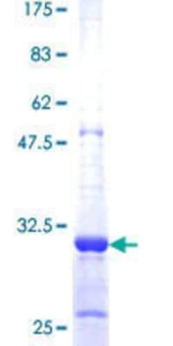 Novus Biologicals Recombinant Human SLMO1 GST (N-Term) Protein 10 &mu;g | Buy Online | Novus Biologicals&trade; | Fisher Scientific