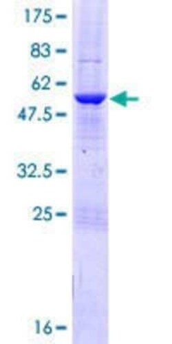 Novus Biologicals Recombinant Human Metaxin-2 GST (N-Term) Protein 10 &mu;g | Buy Online | Novus Biologicals&trade; | Fisher Scientific