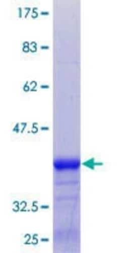 Novus Biologicals Recombinant Human Synaptobrevin homolog YKT6 GST (N-Term) Protein 25 &mu;g | Buy Online | Novus Biologicals&trade; | Fisher Scientific