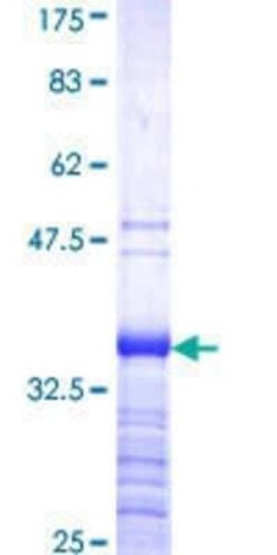 Novus Biologicals Recombinant Human DMRT2 GST (N-Term) Protein 25 &mu;g | Buy Online | Novus Biologicals&trade; | Fisher Scientific