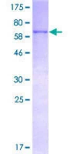 Novus Biologicals Recombinant Human SAM68 GST (N-Term) Protein 25 &mu;g | Buy Online | Novus Biologicals&trade; | Fisher Scientific