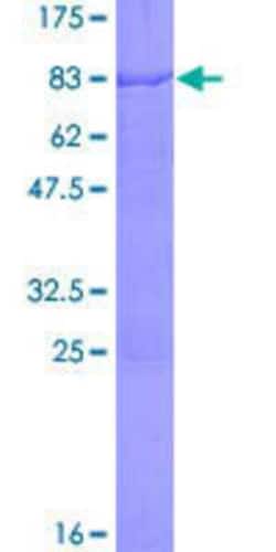 Novus Biologicals Recombinant Human CUGBP2 GST (N-Term) Protein 25 &mu;g | Buy Online | Novus Biologicals&trade; | Fisher Scientific