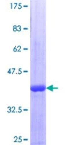 Novus Biologicals Recombinant Human CUGBP2 GST (N-Term) Protein 10 &mu;g | Buy Online | Novus Biologicals&trade; | Fisher Scientific
