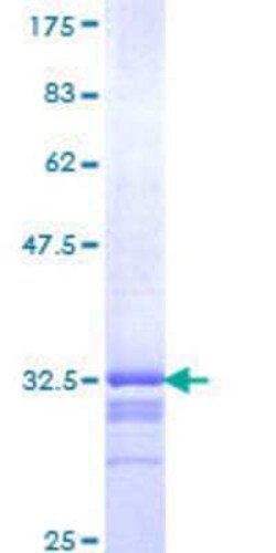 Novus Biologicals Recombinant Human KLF1 GST (N-Term) Protein 25 &mu;g | Buy Online | Novus Biologicals&trade; | Fisher Scientific