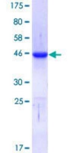 Novus Biologicals Recombinant Human CTCF GST (N-Term) Protein 25 &mu;g | Buy Online | Novus Biologicals&trade; | Fisher Scientific