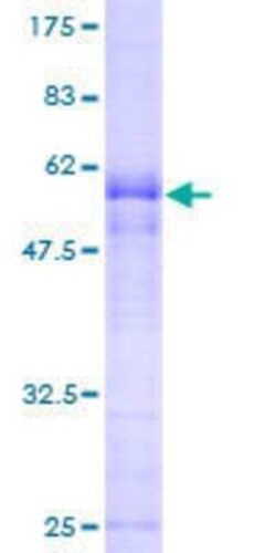 Novus Biologicals Recombinant Human CGR19 GST (N-Term) Protein 25 &mu;g | Buy Online | Novus Biologicals&trade; | Fisher Scientific