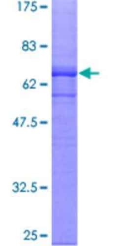 Novus Biologicals Recombinant Human CGR19 GST (N-Term) Protein 10 &mu;g | Buy Online | Novus Biologicals&trade; | Fisher Scientific