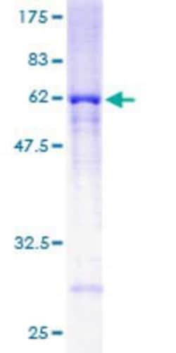 Novus Biologicals Recombinant Human RRAGA GST (N-Term) Protein 25 &mu;g | Buy Online | Novus Biologicals&trade; | Fisher Scientific