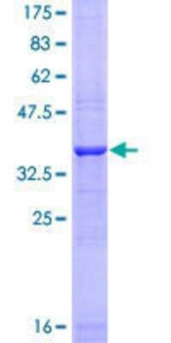 Novus Biologicals Recombinant Human Advillin GST (N-Term) Protein 25 &mu;g | Buy Online | Novus Biologicals&trade; | Fisher Scientific