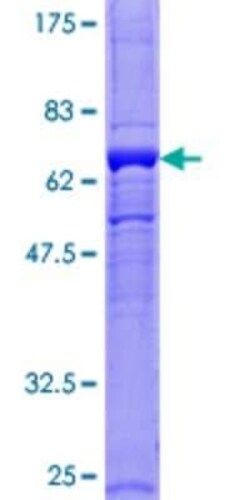 Novus Biologicals Recombinant Human GNB5 GST (N-Term) Protein 25 &mu;g | Buy Online | Novus Biologicals&trade; | Fisher Scientific