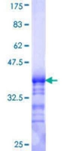 Novus Biologicals Recombinant Human GNB5 GST (N-Term) Protein 10 &mu;g | Buy Online | Novus Biologicals&trade; | Fisher Scientific