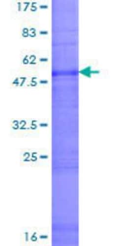 Novus Biologicals Recombinant Human Claudin-16 GST (N-Term) Protein 10 &mu;g | Buy Online | Novus Biologicals&trade; | Fisher Scientific