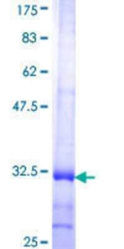 Novus Biologicals Recombinant Human Claudin-16 GST (N-Term) Protein 25 &mu;g | Buy Online | Novus Biologicals&trade; | Fisher Scientific