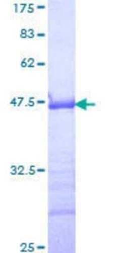 Novus Biologicals Recombinant Human GMEB1 GST (N-Term) Protein 10 &mu;g | Buy Online | Novus Biologicals&trade; | Fisher Scientific