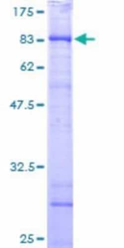 Novus Biologicals Recombinant Human CCT6B GST (N-Term) Protein 10 &mu;g | Buy Online | Novus Biologicals&trade; | Fisher Scientific