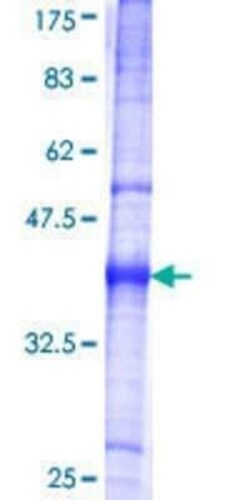 Novus Biologicals Recombinant Human Corin GST (N-Term) Protein 25 &mu;g | Buy Online | Novus Biologicals&trade; | Fisher Scientific