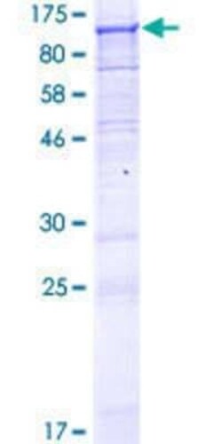 Novus Biologicals Recombinant Human FAM189B GST (N-Term) Protein 10 &mu;g | Buy Online | Novus Biologicals&trade; | Fisher Scientific