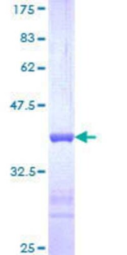 Novus Biologicals Recombinant Human USP39 GST (N-Term) Protein 25 &mu;g | Buy Online | Novus Biologicals&trade; | Fisher Scientific
