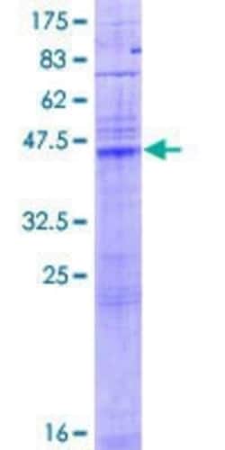 Novus Biologicals Recombinant Human LASS1 GST (N-Term) Protein 25 &mu;g | Buy Online | Novus Biologicals&trade; | Fisher Scientific