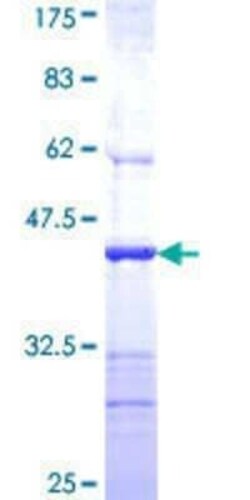 Novus Biologicals Recombinant Human AP4B1 GST (N-Term) Protein 25 &mu;g | Buy Online | Novus Biologicals&trade; | Fisher Scientific