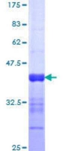 Novus Biologicals Recombinant Human NFAT5 GST (N-Term) Protein 25 &mu;g | Buy Online | Novus Biologicals&trade; | Fisher Scientific