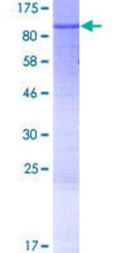 Novus Biologicals Recombinant Human YME1L1 GST (N-Term) Protein 25 &mu;g | Buy Online | Novus Biologicals&trade; | Fisher Scientific