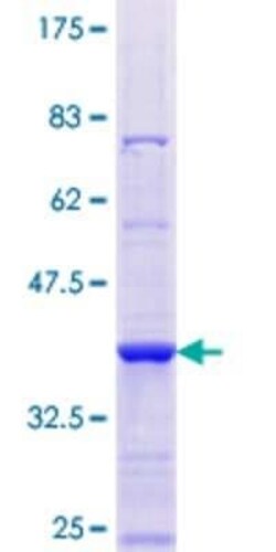 Novus Biologicals Recombinant Human YME1L1 GST (N-Term) Protein 10 &mu;g | Buy Online | Novus Biologicals&trade; | Fisher Scientific