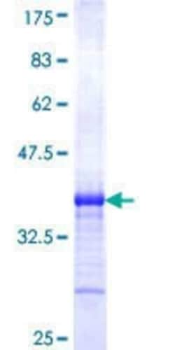 Novus Biologicals Recombinant Human TCFL5 GST (N-Term) Protein 25 &mu;g | Buy Online | Novus Biologicals&trade; | Fisher Scientific