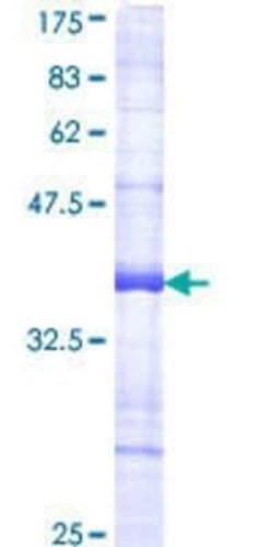 Novus Biologicals Recombinant Human PLK4 GST (N-Term) Protein 10 &mu;g | Buy Online | Novus Biologicals&trade; | Fisher Scientific