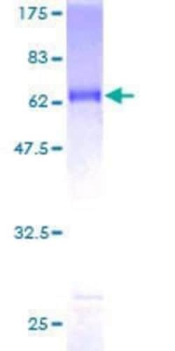 Novus Biologicals Recombinant Human SIX2 GST (N-Term) Protein 10 &mu;g | Buy Online | Novus Biologicals&trade; | Fisher Scientific