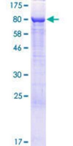 Novus Biologicals Recombinant Human RAI2 GST (N-Term) Protein 10 &mu;g | Buy Online | Novus Biologicals&trade; | Fisher Scientific
