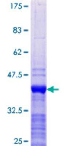 Novus Biologicals Recombinant Human RAI2 GST (N-Term) Protein 10 &mu;g | Buy Online | Novus Biologicals&trade; | Fisher Scientific