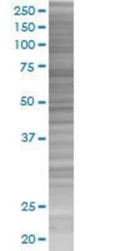 Novus Biologicals PHTF1 293T Cell Transient Overexpression Lysate 0.1 mL | Buy Online | Novus Biologicals&trade; | Fisher Scientific