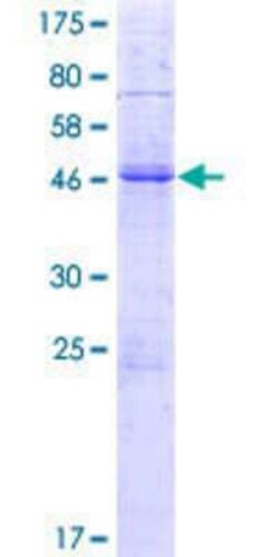Novus Biologicals Recombinant Human KLRA1 GST (N-Term) Protein 10 &mu;g | Buy Online | Novus Biologicals&trade; | Fisher Scientific