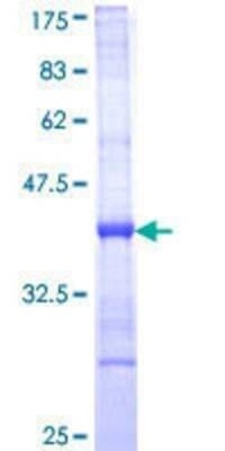 Novus Biologicals Recombinant Human KLRA1 GST (N-Term) Protein 10 &mu;g | Buy Online | Novus Biologicals&trade; | Fisher Scientific