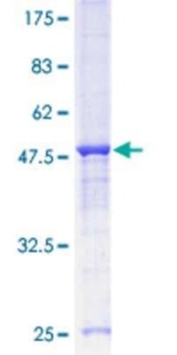 Novus Biologicals Recombinant Human GRAP GST (N-Term) Protein 10 &mu;g | Buy Online | Novus Biologicals&trade; | Fisher Scientific