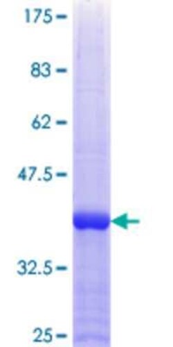 Novus Biologicals Recombinant Human NUP50 GST (N-Term) Protein 25 &mu;g | Buy Online | Novus Biologicals&trade; | Fisher Scientific