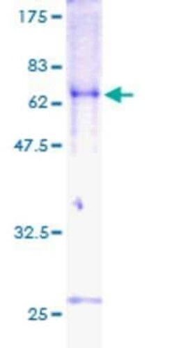 Novus Biologicals Recombinant Human TOB2 GST (N-Term) Protein 25 &mu;g | Buy Online | Novus Biologicals&trade; | Fisher Scientific